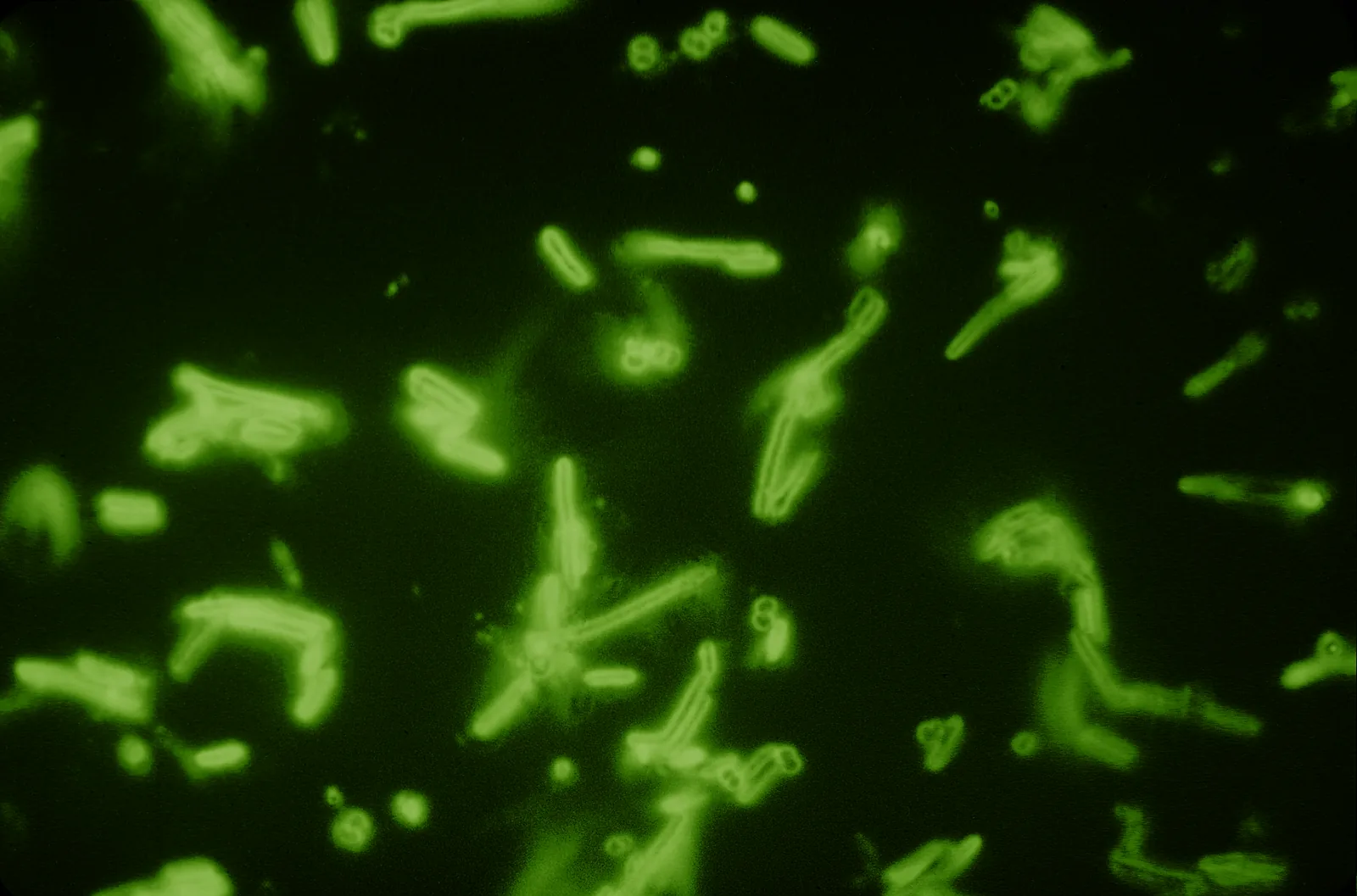 Historic green fluorescence micrograph showing rod-shaped and ovoid bacteria against a dark background