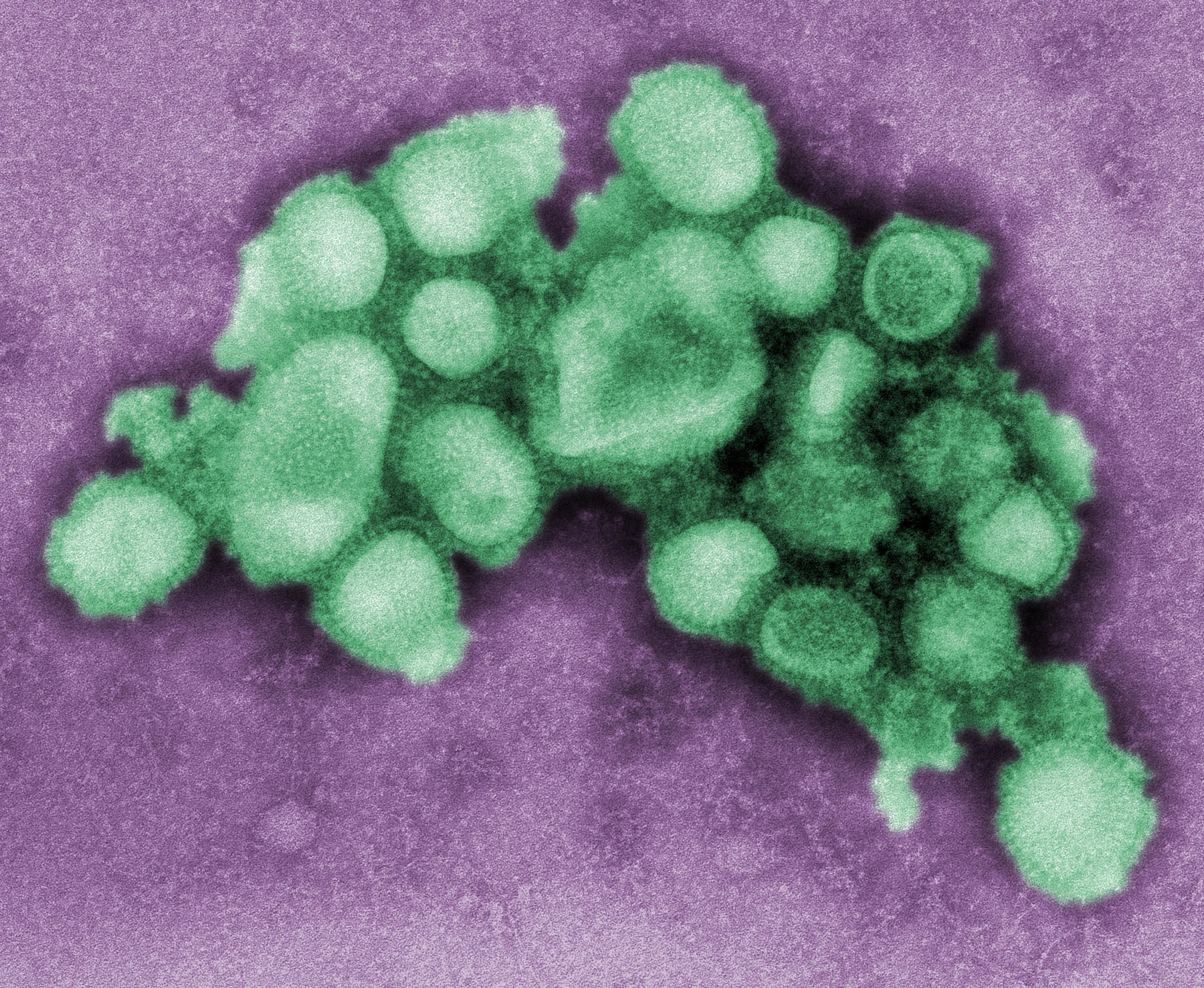 Digitally colorized transmission electron micrograph of 2009 influenza A H1N1 virions